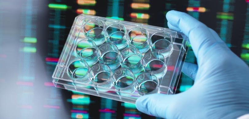 Image of a person with a gloved hand holding a petri dish.